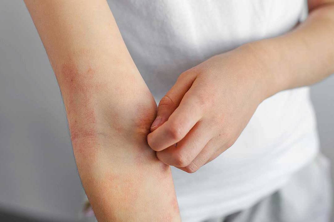 La pelle in terapia